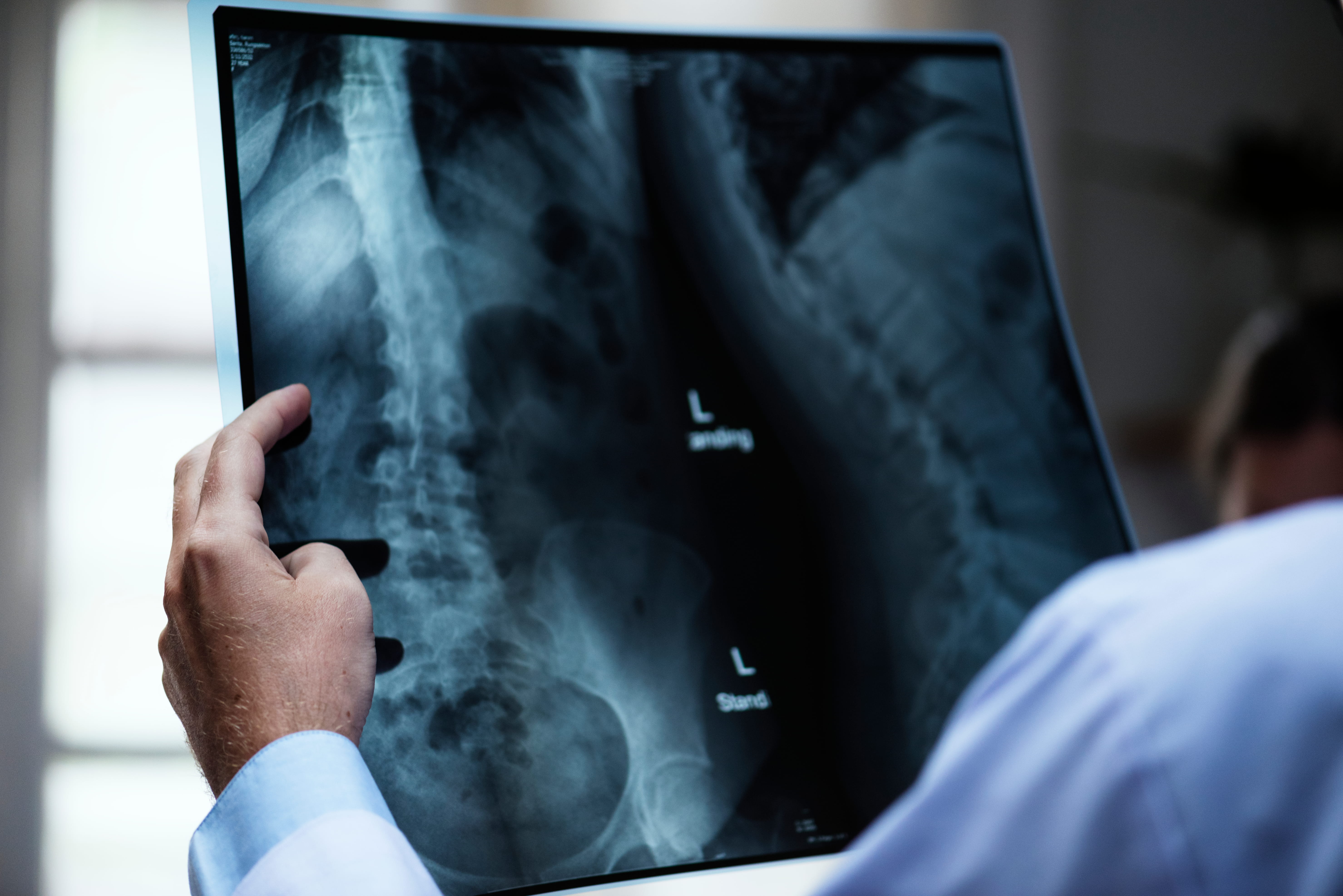 Quais exames podem ser laudados por radiologia? 